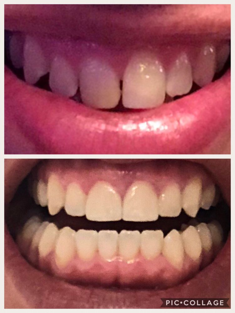 Huebner Smiles Dentistry and Orthodontics